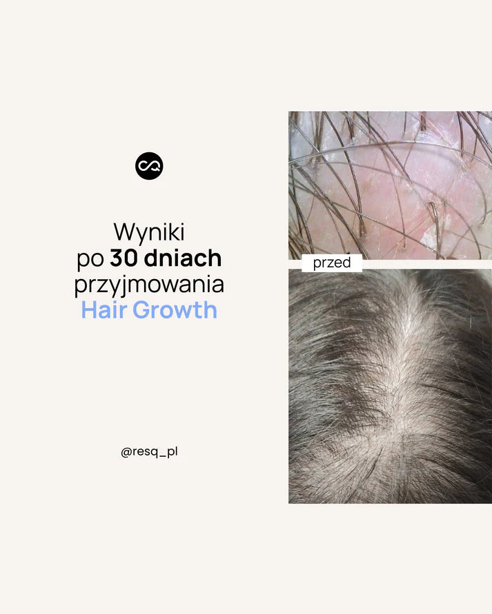 RESQ LAB Hair Growth Formuła wspierająca włosy 30 saszetek
