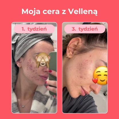 Vellena Kobiece Zdrowie Morela Rokitnik edycja limitowana